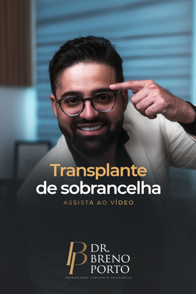 Transplante de Sobrancelha com a Técnica Chinesa Long Hair: Resultado Natural e Imediato!